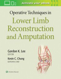 Cover image for Operative Techniques in Lower Limb  Reconstruction and Amputation