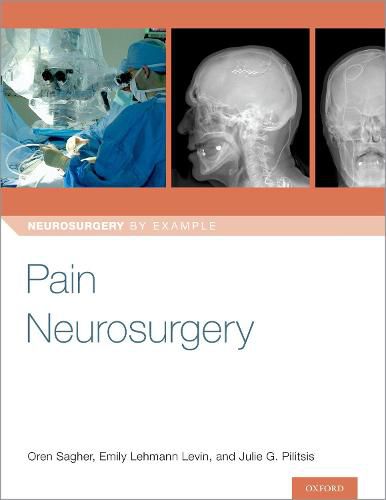 Cover image for Pain Neurosurgery