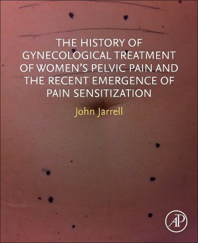 The History of Gynecological Treatment of Women's Pelvic Pain and the Recent Emergence of Pain Sensitization