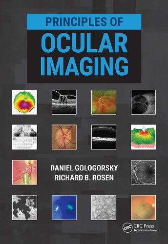 Cover image for Principles of Ocular Imaging