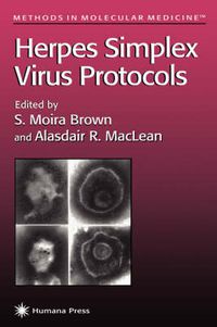 Cover image for Herpes Simplex Virus Protocols