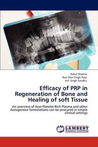 Cover image for Efficacy of Prp in Regeneration of Bone and Healing of Soft Tissue