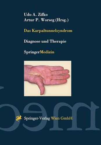 Cover image for Das Karpaltunnelsyndrom: Diagnose Und Therapie