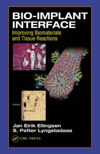 Cover image for Bio-Implant Interface: Improving Biomaterials and Tissue Reactions