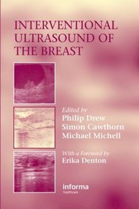 Cover image for Interventional Ultrasound of the Breast