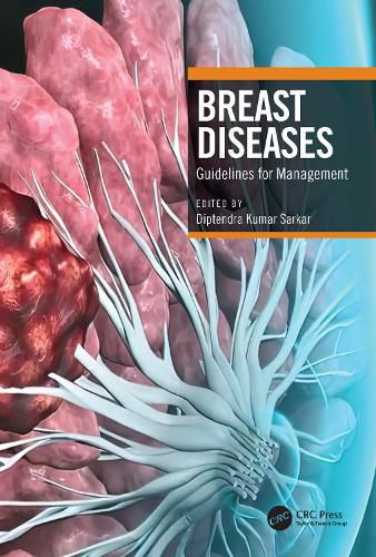 Cover image for Breast Diseases