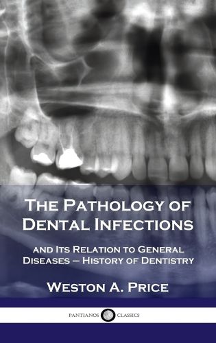 Cover image for Pathology of Dental Infections: and Its Relation to General Diseases - History of Dentistry