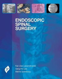 Cover image for Endoscopic Spinal Surgery