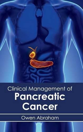 Cover image for Clinical Management of Pancreatic Cancer