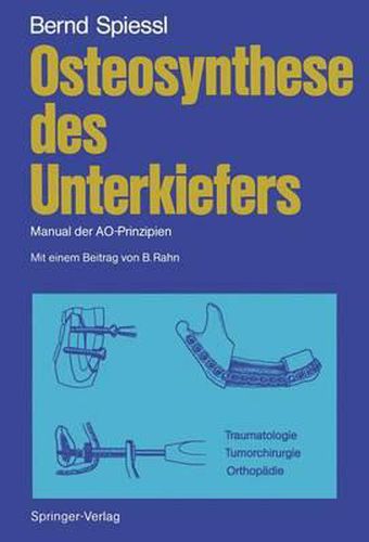 Osteosynthese des Unterkiefers: Manual der AO-Prinzipien