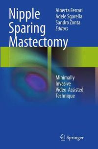 Cover image for Nipple Sparing Mastectomy: Minimally Invasive Video-Assisted Technique