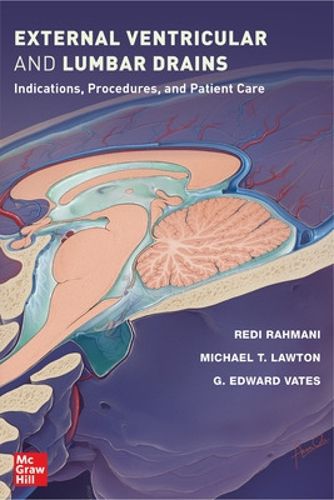 Cover image for External Ventricular and Lumbar Drains: Indications, Procedures, and Patient Care