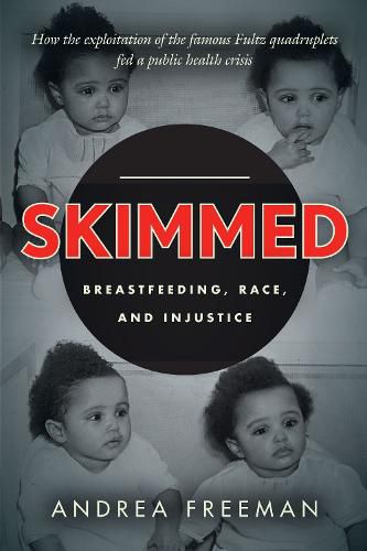 Cover image for Skimmed: Breastfeeding, Race, and Injustice