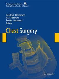 Cover image for Chest Surgery