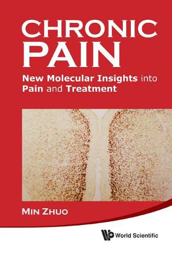 Cover image for Chronic Pain: New Molecular Insights Into Pain And Treatment