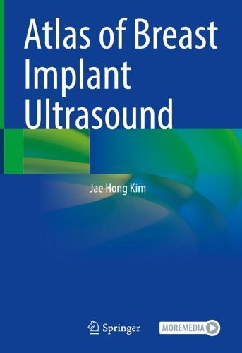Cover image for Atlas of Breast Implant Ultrasound