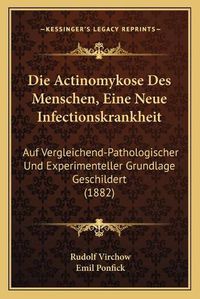 Cover image for Die Actinomykose Des Menschen, Eine Neue Infectionskrankheit: Auf Vergleichend-Pathologischer Und Experimenteller Grundlage Geschildert (1882)