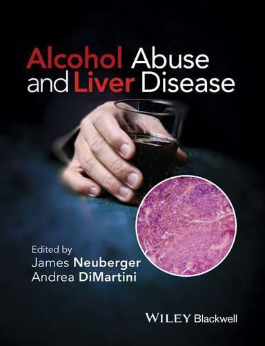 Cover image for Alcohol Abuse and Liver Disease