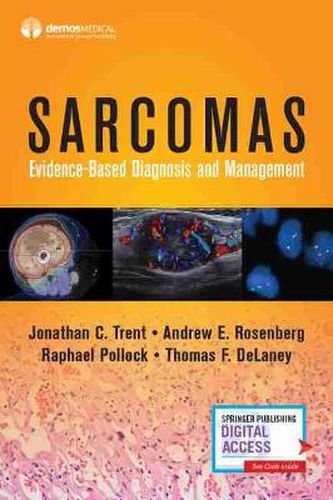 Cover image for Sarcomas: Evidence-based Diagnosis and Management