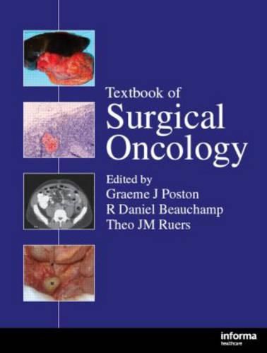 Cover image for Textbook of Surgical Oncology