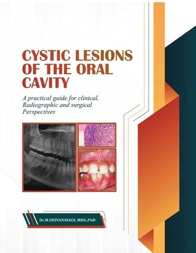 Cover image for Cystic Lesions of the Oral Cavity