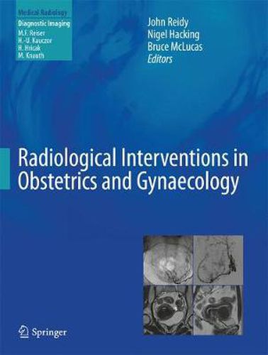 Cover image for Radiological Interventions in Obstetrics and Gynaecology