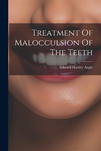 Cover image for Treatment Of Malocculsion Of The Teeth