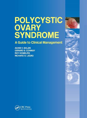 Cover image for Polycystic Ovary Syndrome: A Guide to Clinical Management