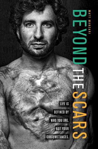 Cover image for Beyond the Scars: Life is Defined by Who You Are, Not Your Circumstances