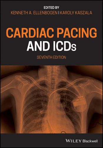 Cover image for Cardiac Pacing and ICDs