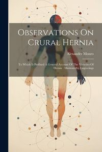 Cover image for Observations On Crural Hernia