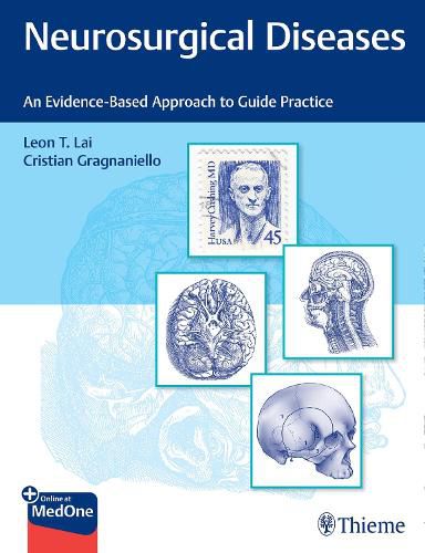 Cover image for Neurosurgical Diseases: An Evidence-Based Approach to Guide Practice