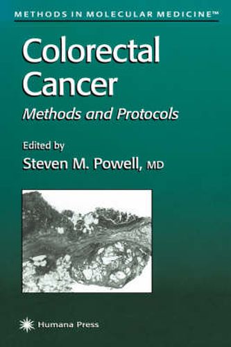 Colorectal Cancer: Methods and Protocols