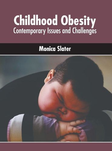 Cover image for Childhood Obesity: Contemporary Issues and Challenges