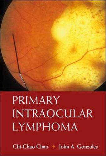 Cover image for Primary Intraocular Lymphoma