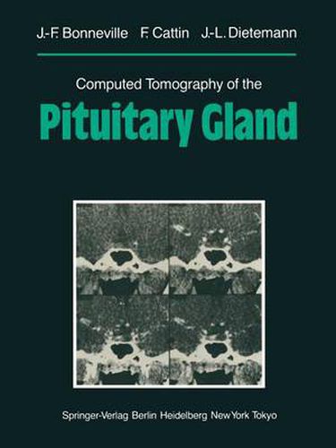 Computed Tomography of the Pituitary Gland: With a Chapter on Magnetic Resonance Imaging of the Sellar and Juxtasellar Region, By M. Mu Huo Teng and K. Sartor