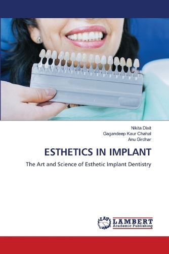 Cover image for Esthetics in Implant