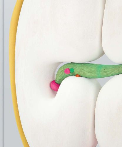 Cover image for Matthew Ronay