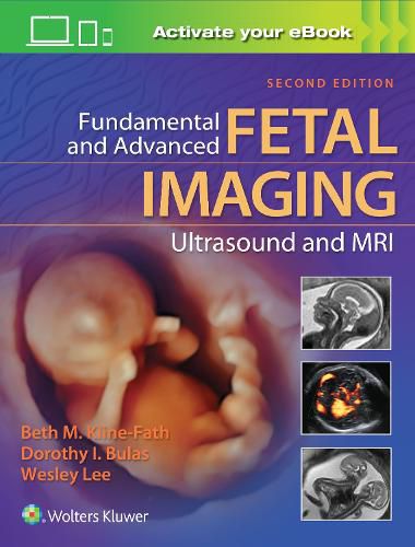 Cover image for Fundamental and Advanced Fetal Imaging Ultrasound and MRI