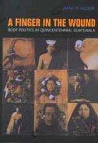 Cover image for A Finger in the Wound: Body Politics in Quincentennial Guatemala