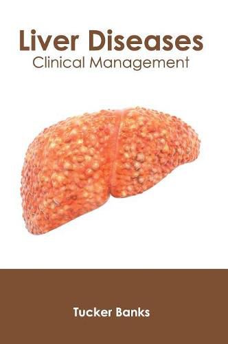 Cover image for Liver Diseases: Clinical Management