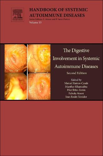 Cover image for The Digestive Involvement in Systemic Autoimmune Diseases