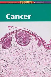 Cover image for Cancer