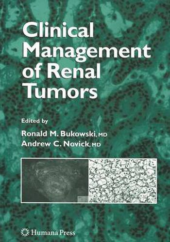 Cover image for Clinical Management of Renal Tumors