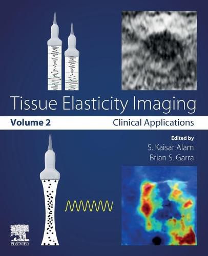 Cover image for Tissue Elasticity Imaging: Volume 2: Clinical Applications