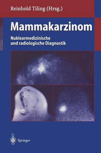 Cover image for Mammakarzinom: Nuklearmedizinische Und Radiologische Diagnostik