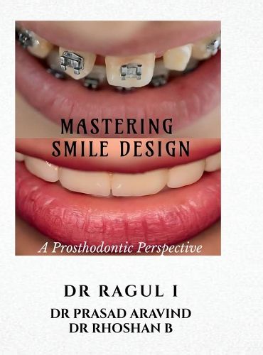 Cover image for Mastering Smile Design