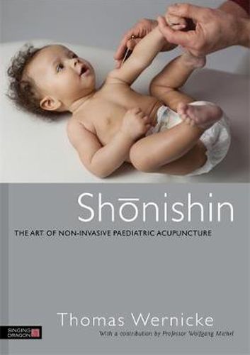 Cover image for Shonishin: The Art of Non-Invasive Paediatric Acupuncture