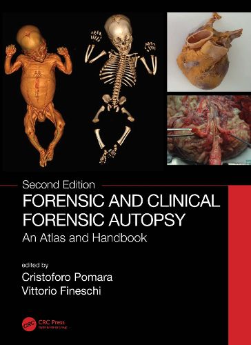 Cover image for Forensic and Clinical Forensic Autopsy: An Atlas and Handbook