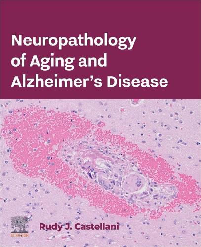 Neuropathology of Aging and Alzheimer's Disease